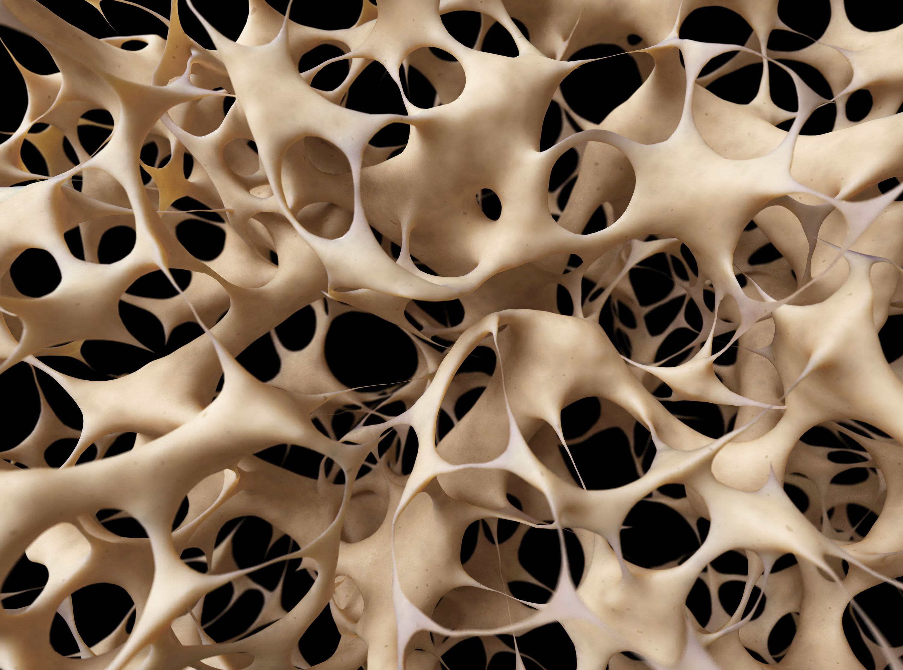 osteoporoza zdrowe kości densytometria witamina D wapń złamania choroby wieku starszego menopauza profilaktyka osteoporozy ćwiczenia na osteoporozę leczenie osteoporozy objawy osteoporozy