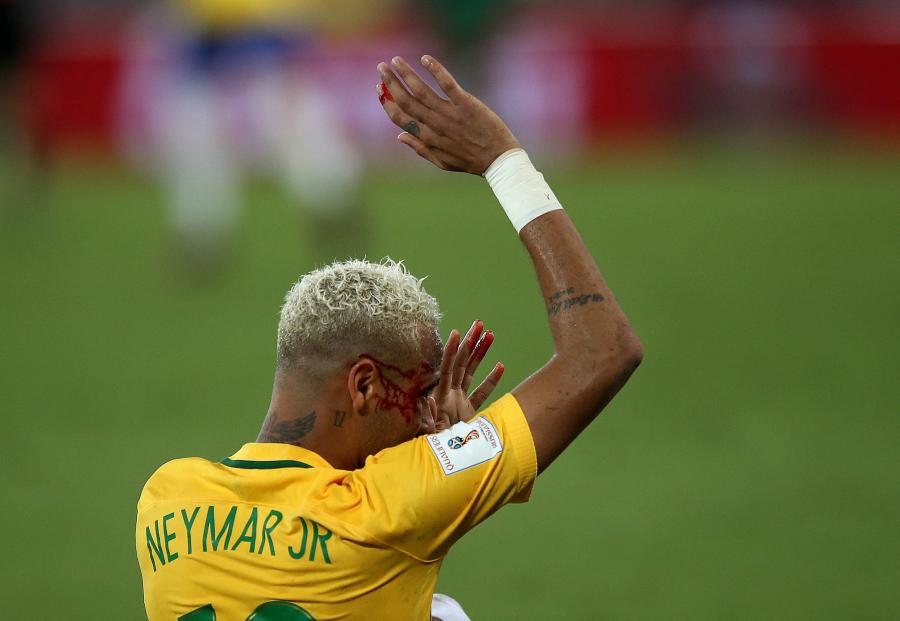 Neymar dostał z "łokcia" i zalał się krwią. Gwiazdor musiał opuścić boisko